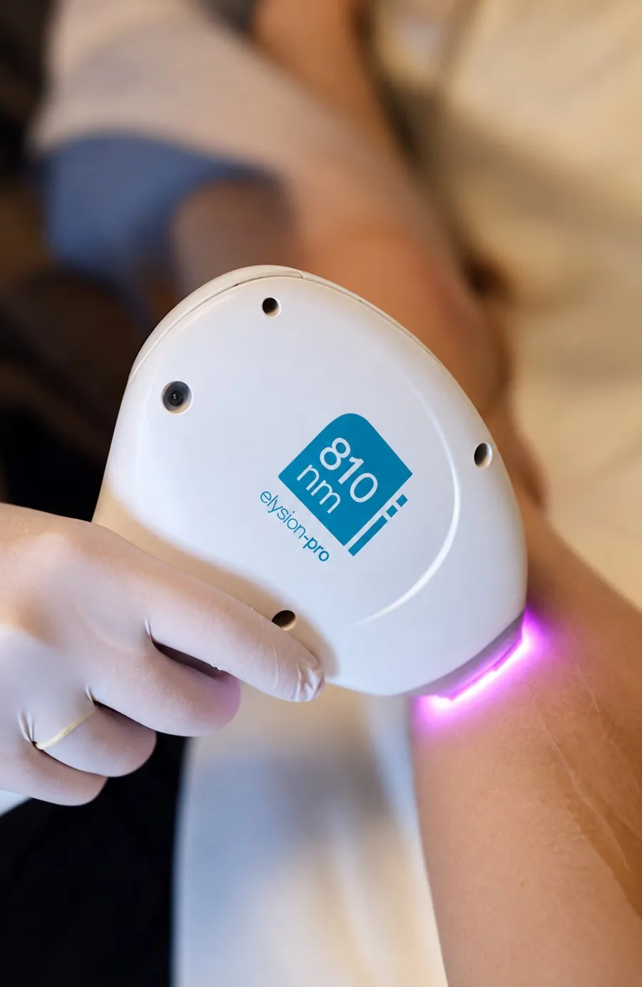 Handstück des Elysion Pro Diodenlasers bei der Behandlung